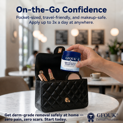✨Official Brand Shop |  GFOUK® 7-𝐃𝐚𝐲 𝐒𝐤𝐢𝐧 𝐓𝐚𝐠 & 𝐒𝐩𝐨𝐭 𝐄𝐫𝐚𝐬𝐞𝐫 𝐂𝐫𝐞𝐚𝐦 (Zero Pain, Zero 𝐒𝐜𝐚𝐫𝐬 Formula)
