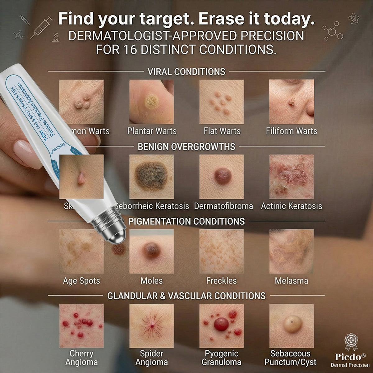 🌟Official Brand Shop | Rolimey® 7-Day Roll-On for Skin Spots and Skin Tags – Pain-Free & Scar-Free