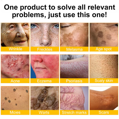 💫🧑‍⚕️Rolimey® Bee venom Pro Comprehensive Cream —Tightening for Skin Types 🔥