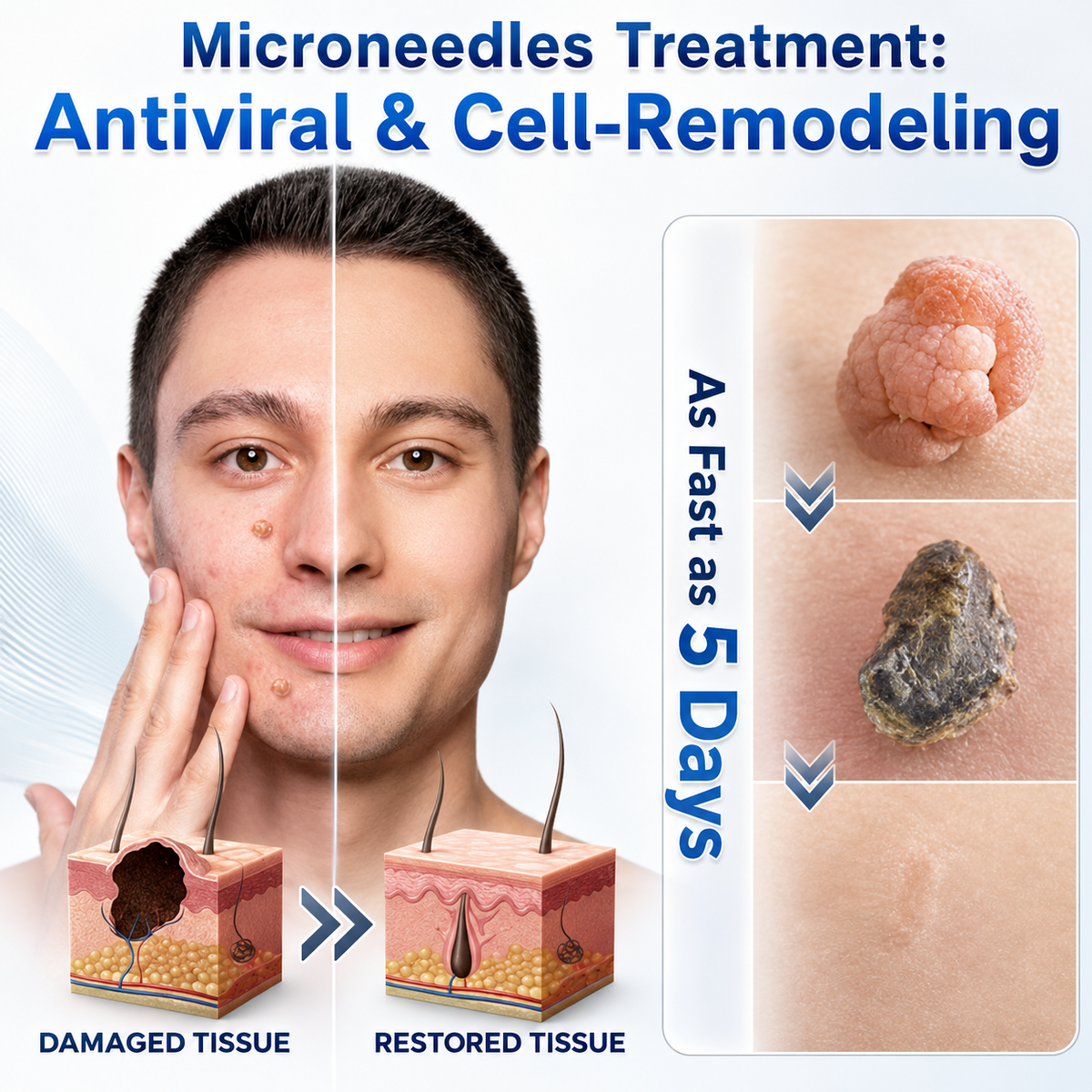 👍Official Brand Shop  | ☘️GFOUK®  Microneedle Skin Tag Removal Patch(𝐅𝐨𝐫 𝐒𝐤𝐢𝐧 𝐓𝐚𝐠𝐬, 𝐒𝐦𝐚𝐥𝐥 𝐒𝐤𝐢𝐧 𝐆𝐫𝐨𝐰𝐭𝐡𝐬, 𝐖𝐚𝐫𝐭𝐬, 𝐌𝐨𝐥𝐞𝐬, 𝐀𝐠𝐞 𝐒𝐩𝐨𝐭𝐬 & 𝐏𝐢𝐠𝐦𝐞𝐧𝐭𝐚𝐭𝐢𝐨𝐧 𝐂𝐨𝐧𝐜𝐞𝐫𝐧𝐬)