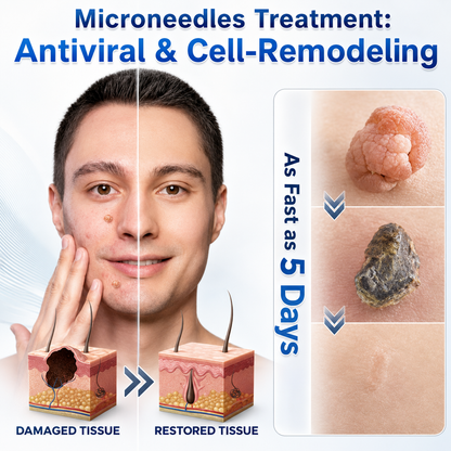 👍Official Brand Shop  | ☘️GFOUK®  Microneedle Skin Tag Removal Patch(𝐅𝐨𝐫 𝐒𝐤𝐢𝐧 𝐓𝐚𝐠𝐬, 𝐒𝐦𝐚𝐥𝐥 𝐒𝐤𝐢𝐧 𝐆𝐫𝐨𝐰𝐭𝐡𝐬, 𝐖𝐚𝐫𝐭𝐬, 𝐌𝐨𝐥𝐞𝐬, 𝐀𝐠𝐞 𝐒𝐩𝐨𝐭𝐬 & 𝐏𝐢𝐠𝐦𝐞𝐧𝐭𝐚𝐭𝐢𝐨𝐧 𝐂𝐨𝐧𝐜𝐞𝐫𝐧𝐬)