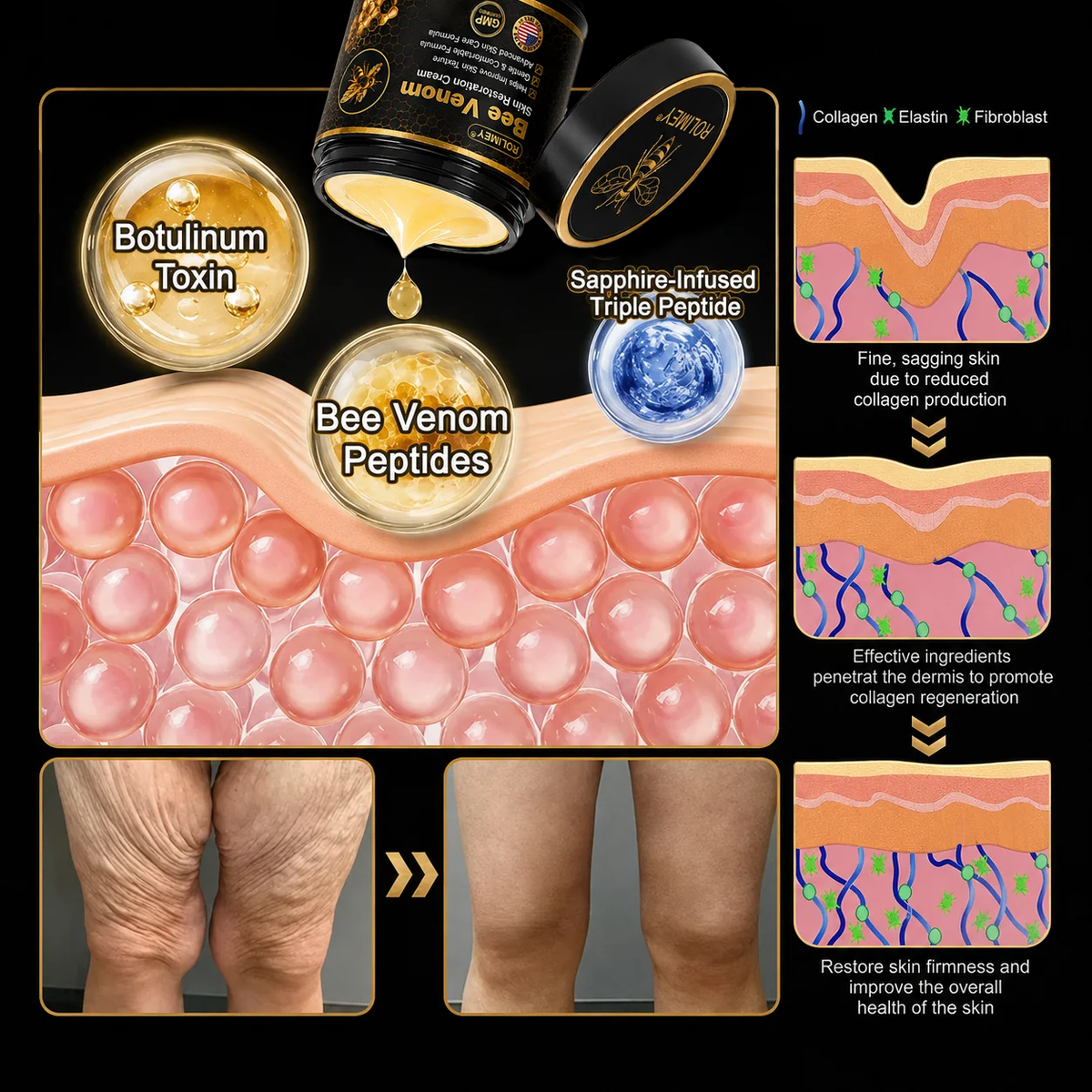 💎Official Brand Black & Gold Upgraded Edition丨Rolimey® Bee venom Pro Comprehensive Cream —Tightening for Skin Types