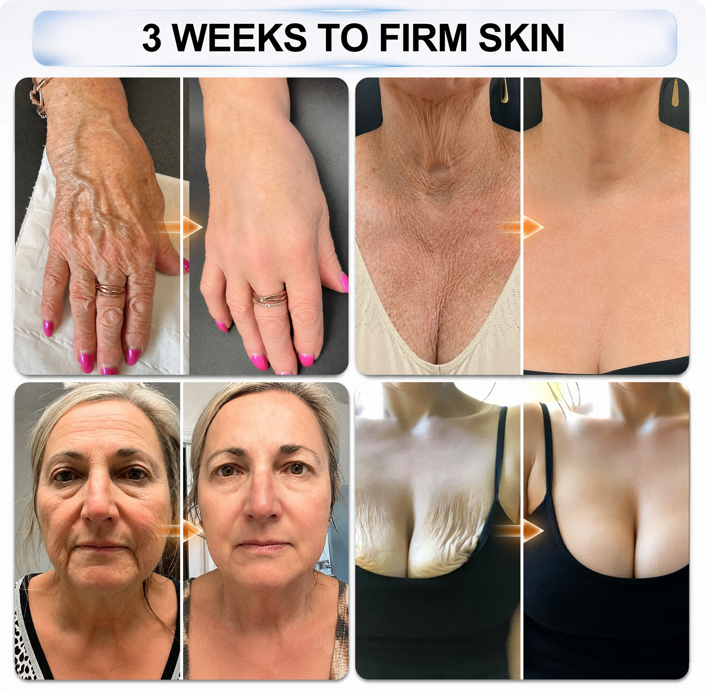 𝐏𝐡𝐚𝐫𝐦𝐚𝐜𝐢𝐬𝐭 𝐑𝐞𝐜𝐨𝐦𝐦𝐞𝐧𝐝𝐞𝐝 👩‍⚕️🏆Rolimey® 𝟖-𝐀𝐂𝐓𝐈𝐕𝐄 • 𝐋𝐎𝐍𝐆𝐄𝐕𝐈𝐓𝐘 𝐈𝐍𝐅𝐔𝐒𝐈𝐎𝐍-𝐃𝐮𝐚𝐥 𝐌𝐢𝐧𝐢𝐏𝐫𝐨𝐭𝐞𝐢𝐧 & 𝐂𝐞𝐥𝐥𝐮𝐥𝐚𝐫 𝐀𝐧𝐭𝐢𝐨𝐱𝐢𝐝𝐚𝐧𝐭 𝐒𝐨𝐥𝐢𝐝 𝐒𝐞𝐫𝐮𝐦 𝐒𝐭𝐢𝐜𝐤(𝐁𝐞𝐲𝐨𝐧𝐝 𝐒𝐮𝐫𝐟𝐚𝐜𝐞 𝐒𝐦𝐨𝐨𝐭𝐡𝐢𝐧𝐠: 𝐄𝐱𝐭𝐞𝐧𝐝 𝐘𝐨𝐮𝐫 𝐒𝐤𝐢𝐧’𝐬 𝐘𝐨𝐮𝐭𝐡 𝐋𝐢𝐟𝐞𝐬𝐩𝐚𝐧 𝐢𝐧 𝐚 𝐒𝐢𝐧𝐠𝐥𝐞 𝐒𝐰𝐢𝐩𝐞)