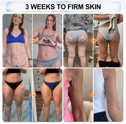 𝐏𝐡𝐚𝐫𝐦𝐚𝐜𝐢𝐬𝐭 𝐑𝐞𝐜𝐨𝐦𝐦𝐞𝐧𝐝𝐞𝐝 👩‍⚕️🏆Rolimey® 𝟖-𝐀𝐂𝐓𝐈𝐕𝐄 • 𝐋𝐎𝐍𝐆𝐄𝐕𝐈𝐓𝐘 𝐈𝐍𝐅𝐔𝐒𝐈𝐎𝐍-𝐃𝐮𝐚𝐥 𝐌𝐢𝐧𝐢𝐏𝐫𝐨𝐭𝐞𝐢𝐧 & 𝐂𝐞𝐥𝐥𝐮𝐥𝐚𝐫 𝐀𝐧𝐭𝐢𝐨𝐱𝐢𝐝𝐚𝐧𝐭 𝐒𝐨𝐥𝐢𝐝 𝐒𝐞𝐫𝐮𝐦 𝐒𝐭𝐢𝐜𝐤(𝐁𝐞𝐲𝐨𝐧𝐝 𝐒𝐮𝐫𝐟𝐚𝐜𝐞 𝐒𝐦𝐨𝐨𝐭𝐡𝐢𝐧𝐠: 𝐄𝐱𝐭𝐞𝐧𝐝 𝐘𝐨𝐮𝐫 𝐒𝐤𝐢𝐧’𝐬 𝐘𝐨𝐮𝐭𝐡 𝐋𝐢𝐟𝐞𝐬𝐩𝐚𝐧 𝐢𝐧 𝐚 𝐒𝐢𝐧𝐠𝐥𝐞 𝐒𝐰𝐢𝐩𝐞)