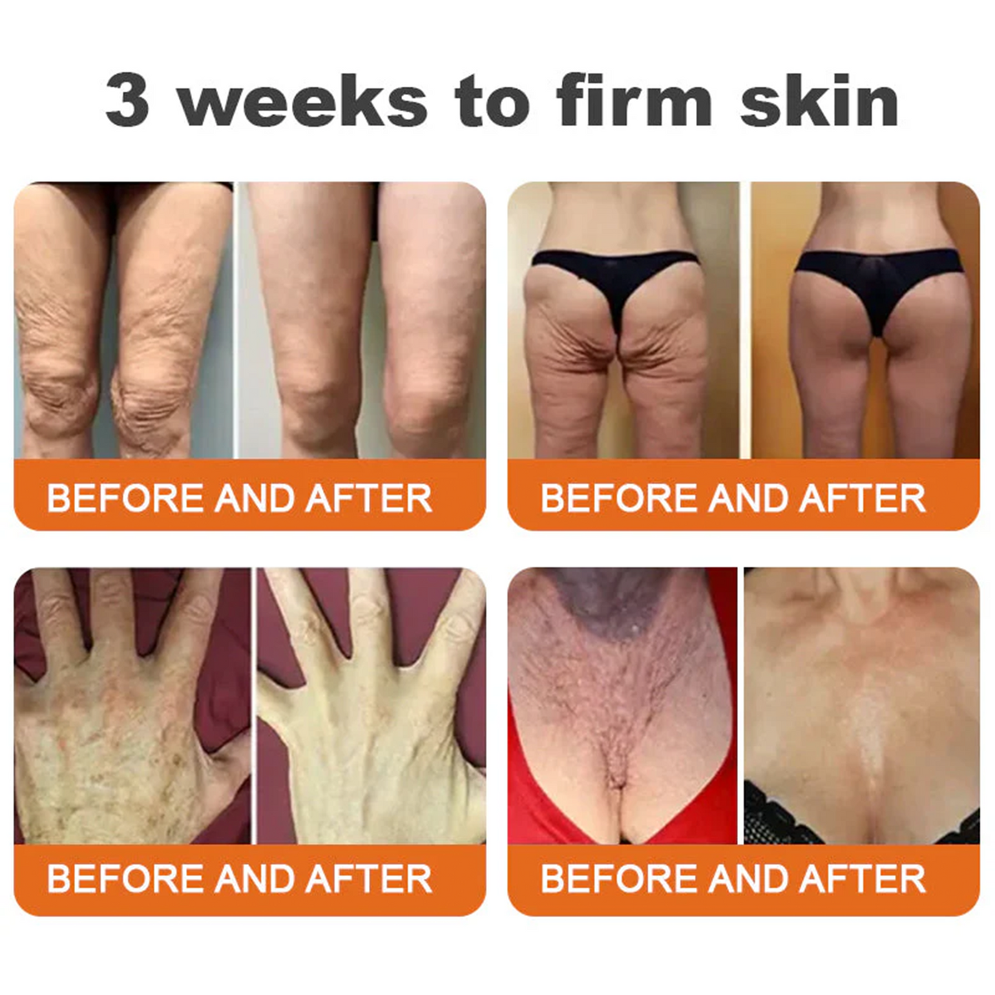 💫🧑‍⚕️Rolimey® Bee venom Pro Comprehensive Cream —Tightening for Skin Types 🔥