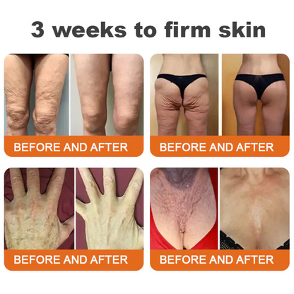 💫🧑‍⚕️Rolimey® Bee venom Pro Comprehensive Cream —Tightening for Skin Types 🔥