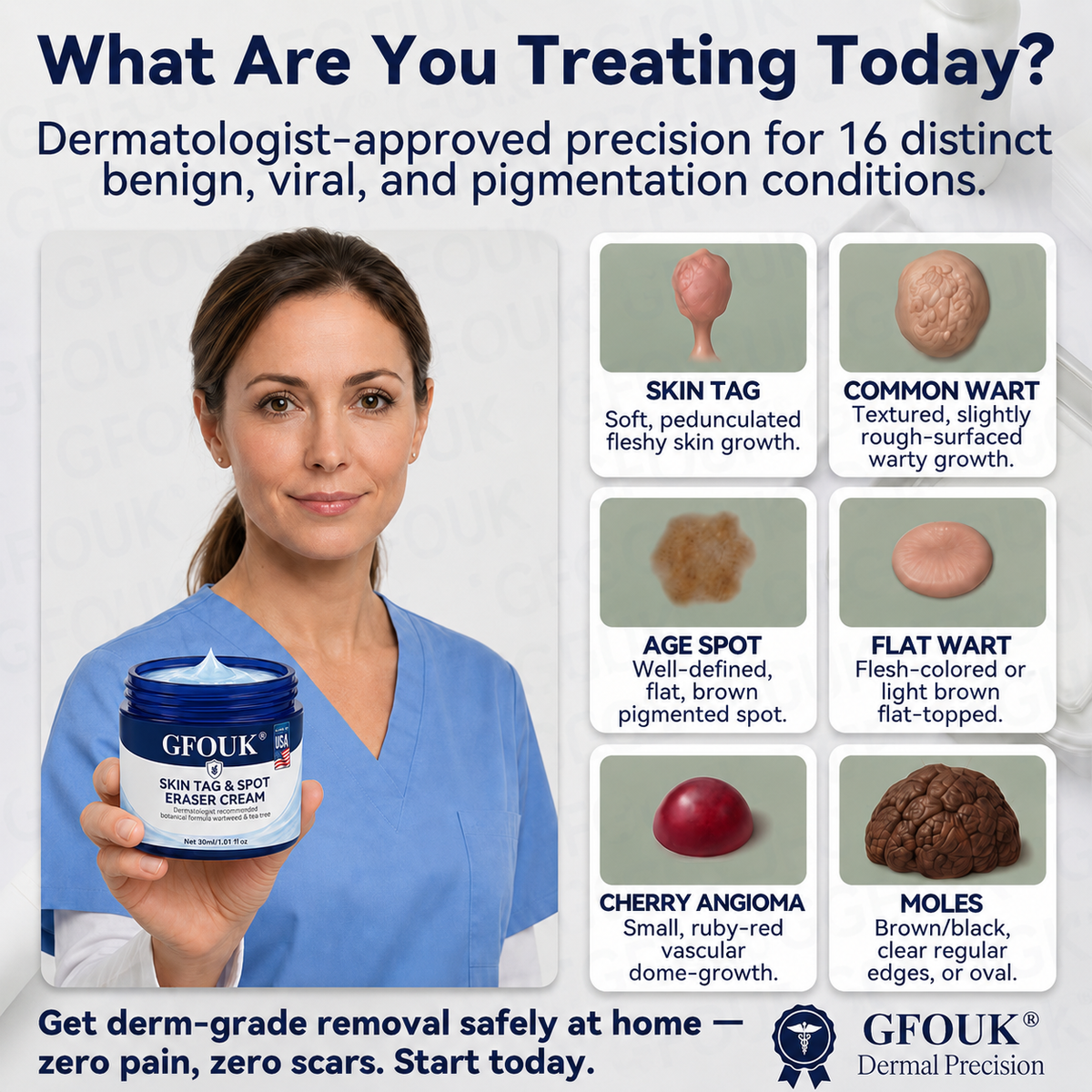 ✨Official Brand Shop |  GFOUK® 7-𝐃𝐚𝐲 𝐒𝐤𝐢𝐧 𝐓𝐚𝐠 & 𝐒𝐩𝐨𝐭 𝐄𝐫𝐚𝐬𝐞𝐫 𝐂𝐫𝐞𝐚𝐦 (Zero Pain, Zero 𝐒𝐜𝐚𝐫𝐬 Formula)