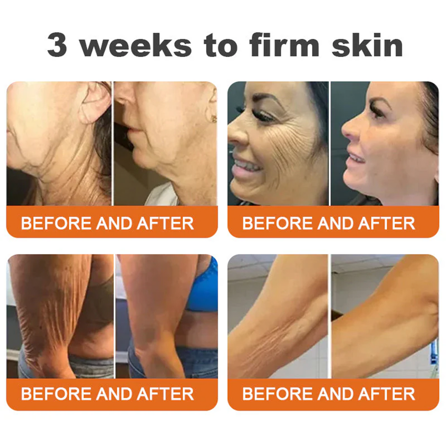 💫🧑‍⚕️Rolimey® Bee venom Pro Comprehensive Cream —Tightening for Skin Types 🔥