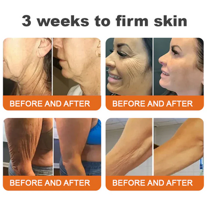 💫🧑‍⚕️Rolimey® Bee venom Pro Comprehensive Cream —Tightening for Skin Types 🔥
