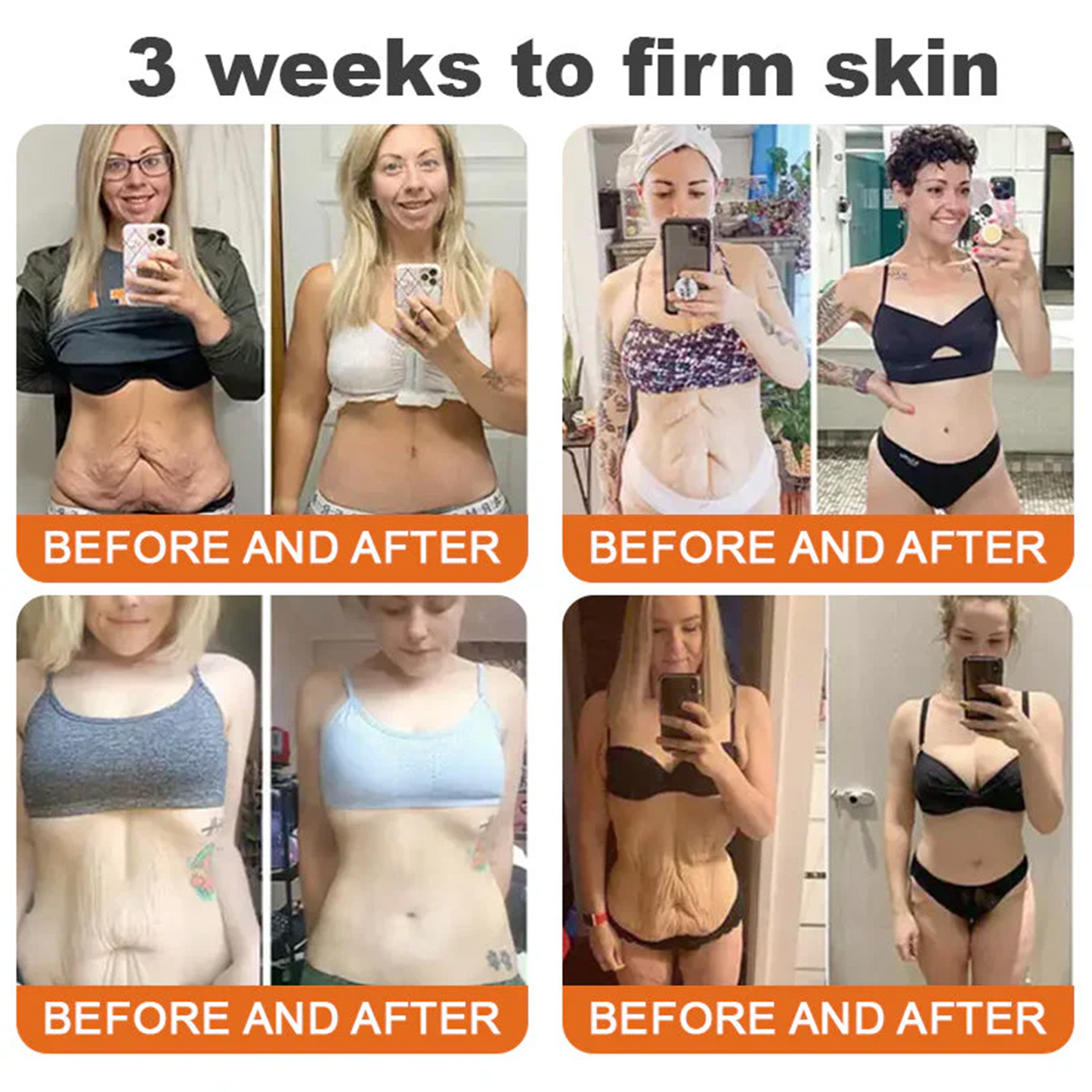 💫🧑‍⚕️Rolimey® Bee venom Pro Comprehensive Cream —Tightening for Skin Types 🔥