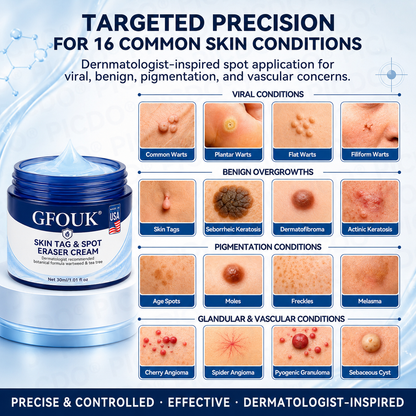 ✨Official Brand Shop |  GFOUK® 7-𝐃𝐚𝐲 𝐒𝐤𝐢𝐧 𝐓𝐚𝐠 & 𝐒𝐩𝐨𝐭 𝐄𝐫𝐚𝐬𝐞𝐫 𝐂𝐫𝐞𝐚𝐦 (Zero Pain, Zero 𝐒𝐜𝐚𝐫𝐬 Formula)