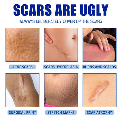🧑‍⚕️🧑‍⚕️Final 3 Hours: 70%OFF🔥 GFOUK® Scar Repair Cream for Men and Women, fade scars and tighten skin in one step