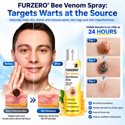 🌻Official Brand Shop  | Furzero® Bee Venom Wart Removal Spray Say Goodbye to Stubborn Warts & Reveal Healthier-Looking Skin