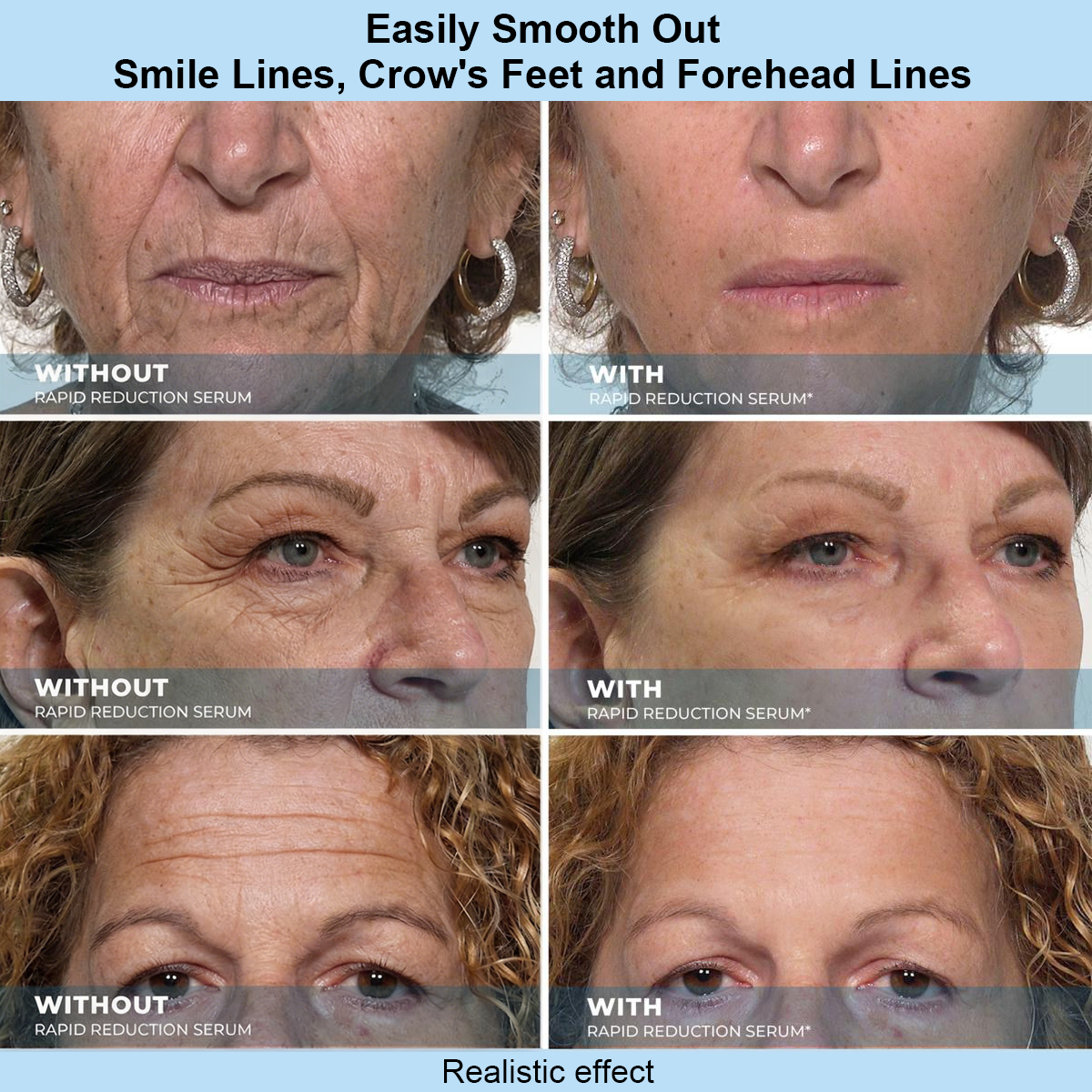 Trilumia SKIN SCIENCE PEPTIDE LIFTING EYE TREATMENT TARGETS PUFFINESS