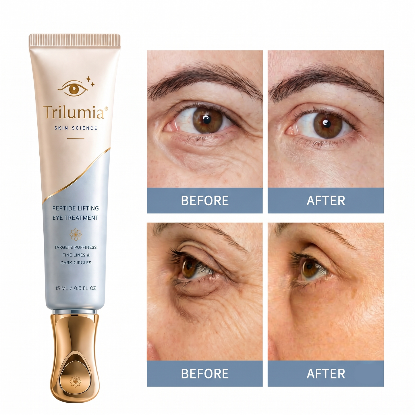 🔥 𝐅𝐥𝐚𝐬𝐡 𝐒𝐚𝐥𝐞: 𝟕𝟎% 𝐎𝐅𝐅 –𝐓𝐫𝐢𝐥𝐮𝐦𝐢𝐚® 𝐈𝐧𝐬𝐭𝐚𝐧𝐭 𝐅𝐚𝐜𝐞 𝐓𝐞𝐦𝐩𝐨𝐫𝐚𝐫𝐲 𝐓𝐢𝐠𝐡𝐭𝐞𝐧𝐞𝐫 – 𝐈𝐧𝐬𝐭𝐚𝐧𝐭 𝐯𝐢𝐬𝐢𝐛𝐥𝐞 𝐫𝐞𝐬𝐮𝐥𝐭𝐬 𝐢𝐧 𝟑𝟎 𝐬𝐞𝐜𝐨𝐧𝐝𝐬