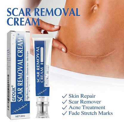 🧑‍⚕️🧑‍⚕️Final 3 Hours: 70%OFF🔥 GFOUK® Scar Repair Cream for Men and Women, fade scars and tighten skin in one step