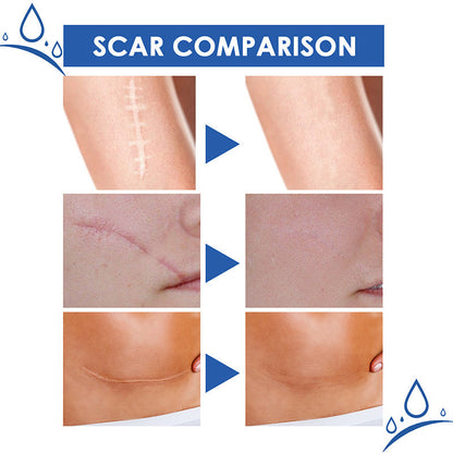 🧑‍⚕️🧑‍⚕️Final 3 Hours: 70%OFF🔥 GFOUK® Scar Repair Cream for Men and Women, fade scars and tighten skin in one step