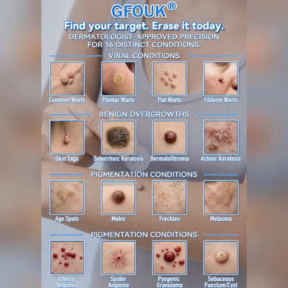👍Official Brand Shop  | ☘️GFOUK®  Microneedle Skin Tag Removal Patch(𝐅𝐨𝐫 𝐒𝐤𝐢𝐧 𝐓𝐚𝐠𝐬, 𝐒𝐦𝐚𝐥𝐥 𝐒𝐤𝐢𝐧 𝐆𝐫𝐨𝐰𝐭𝐡𝐬, 𝐖𝐚𝐫𝐭𝐬, 𝐌𝐨𝐥𝐞𝐬, 𝐀𝐠𝐞 𝐒𝐩𝐨𝐭𝐬 & 𝐏𝐢𝐠𝐦𝐞𝐧𝐭𝐚𝐭𝐢𝐨𝐧 𝐂𝐨𝐧𝐜𝐞𝐫𝐧𝐬)